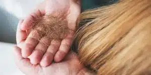Seasonal Changes- How Do They Affect Scalp Health and Hair Care Needs?