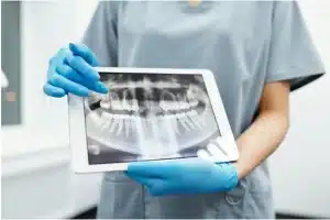 Choosing the Right Dentist in Allentown for Family Dental Care