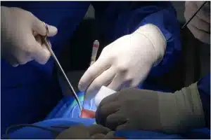 The Complete Guide to Spine Surgery in New Jersey