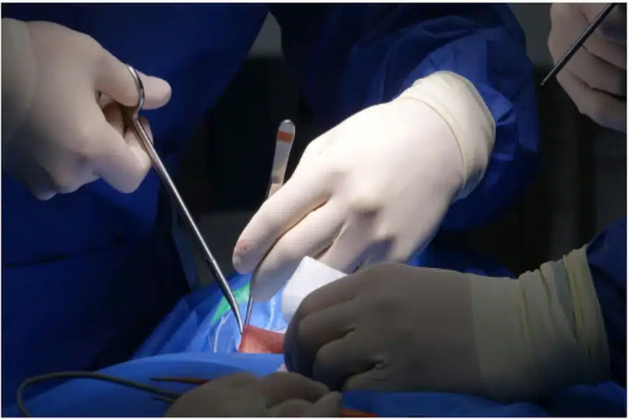 Spine Surgery