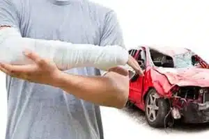 The Most Common Reasons You May Need Physical Therapy After a Car Accident