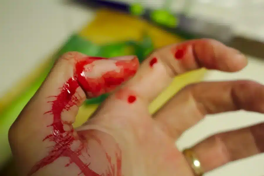 Severe Bleeding