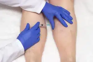 Vein Treatment Options to Restore Comfort and Confidence