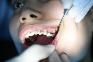 Top Tips for Dental Emergencies: What You Need to Know