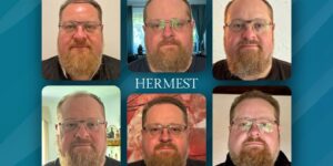 Hermest Hair Clinic Before and After Results: What 17,000 Procedures and 99% Graft Survival Actually Look Like