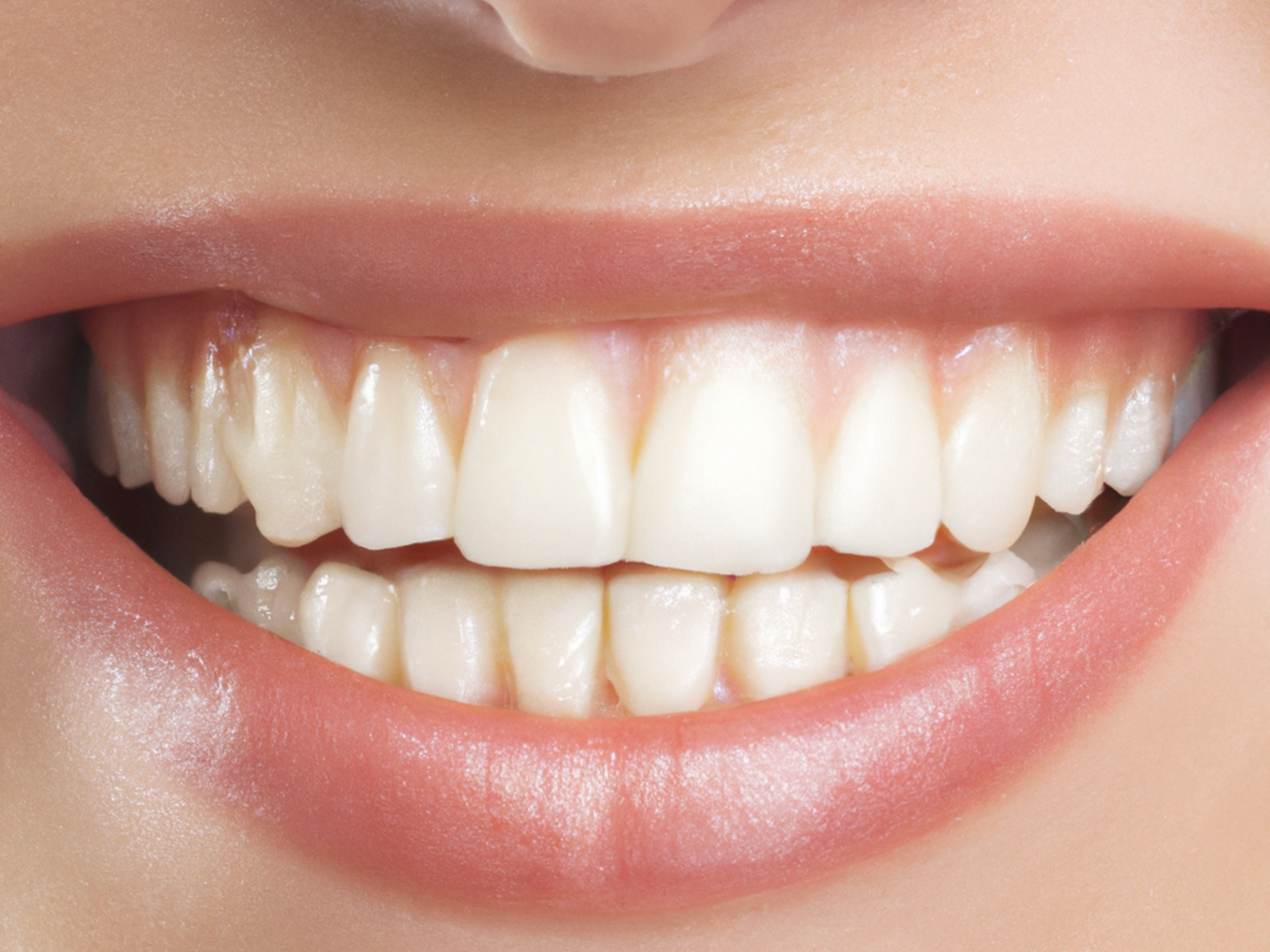 causes of enamel